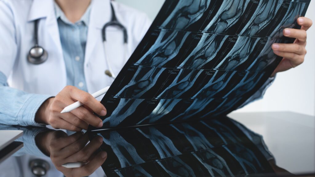 A doctor reviews a series of X-rays showing detailed images of a knee joint. The doctor is holding a pen and examining the scans, likely assessing the condition of the bones and joints for a potential diagnosis or surgical intervention.